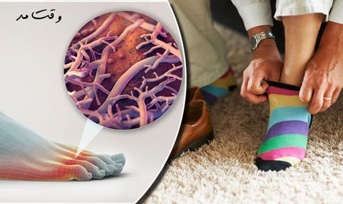 مدلی زیبا از جوراب طرح متفاوت و رنگی که مانع بیماری قارچی می شوند را مشاهده می کنید.