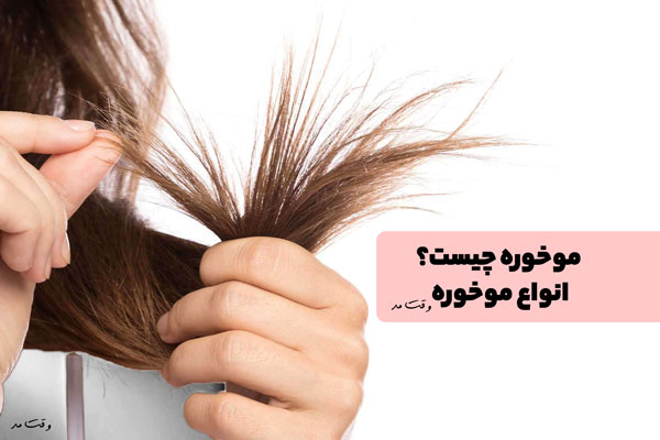 تشخیص موخره بر روی موی سر که نمونه آن در عکس وجود دارد