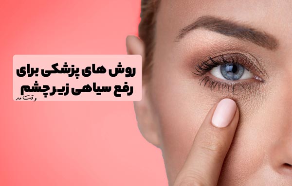 درمان و رفع سیاهی، کبودی دور و زیر چشم