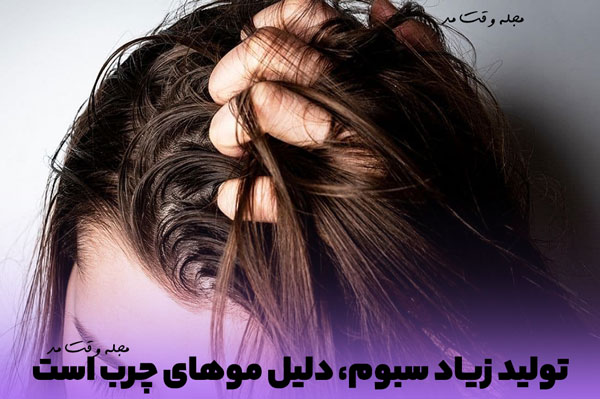 یکی از دلایل موهای چرب، تولید زیاد سبوم مو و پوست است