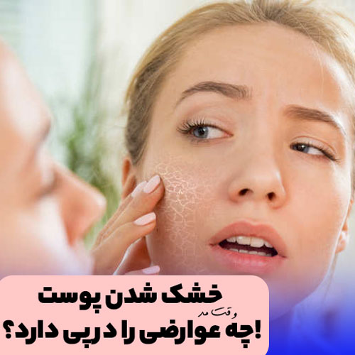 بیماری ناشی از خشکی پوست صورت