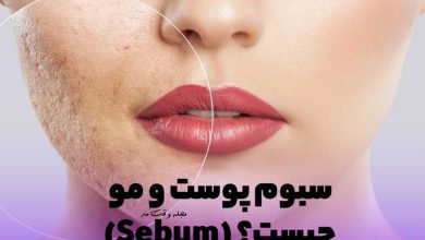 شرح کامل سبوم پوست و مو و درمان، کنترل و آموزش آن