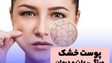 علایم و ویژگی پوست خشک