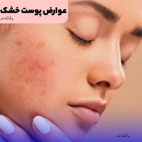 عوارض و بیماری از پوست خشک را مشاهده می کنید.
