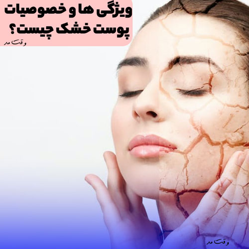 همه اطلاعات مهم درمورد پوست خشک (Dry skin) ✋🏻 مجله وقت مد