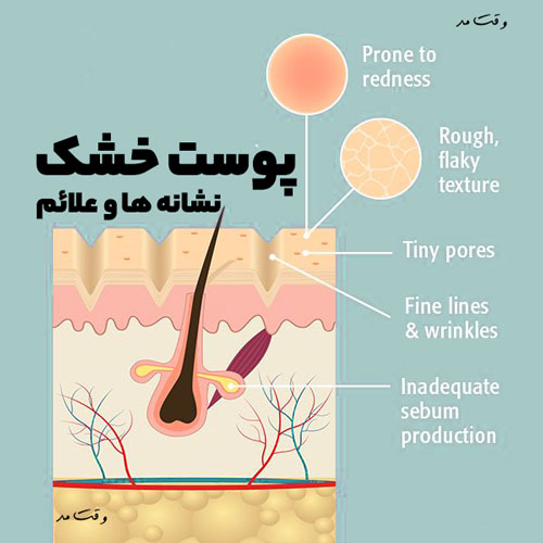 علت خشک شدن پوست صورت را مشاهده می کنید.