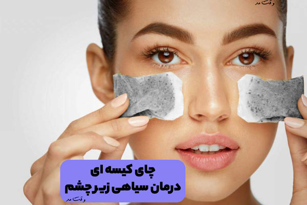 درمان سیاهی و کبودی دور چشم با چای کیسه ای و درمان خانگی