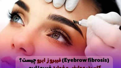 فیبروز ابرو دخترانه