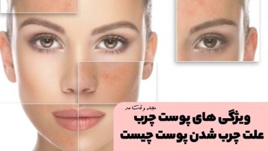 نمونه ای از پوست چرب را مشاهده میکنید.