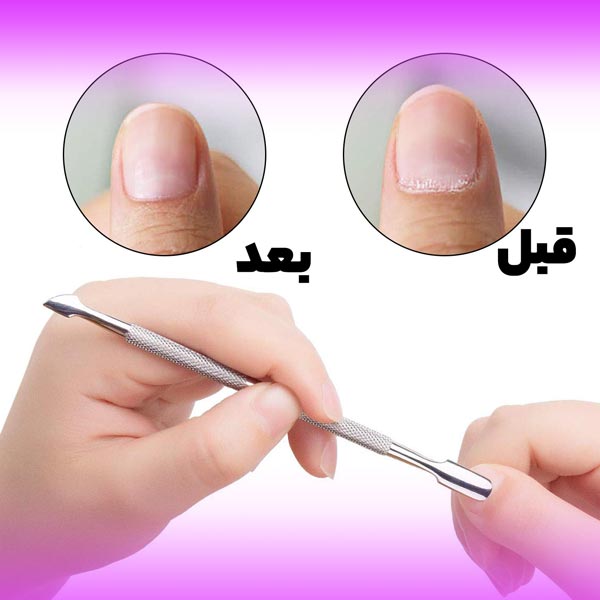 تصویری از قبل و بعد لمینت ناخن