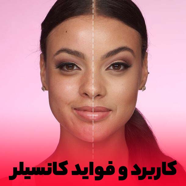 بعد از استفاده از کانسیلر لکه و آکنه صورت محو میشود.