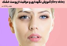 نمونه ای از پوست خشک که نیاز به مراقبت دارد.