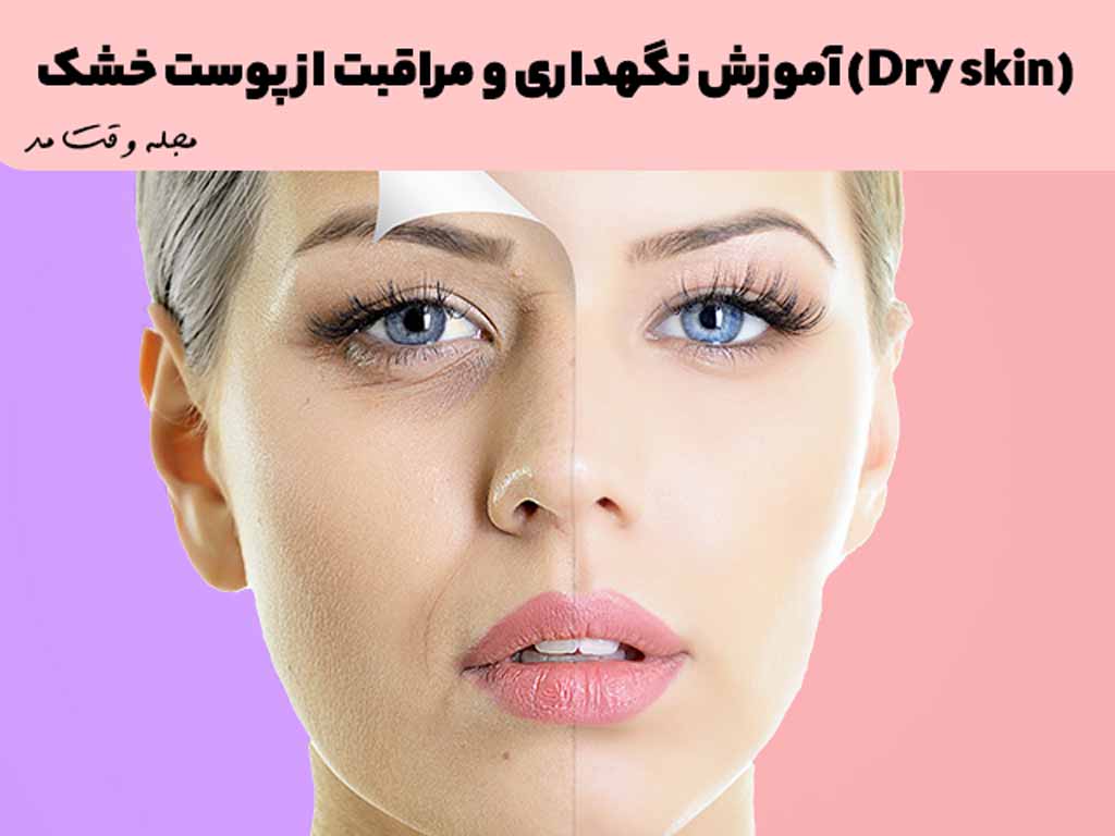 نمونه ای از پوست خشک که نیاز به مراقبت دارد.