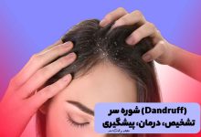 شوره سر و خارش