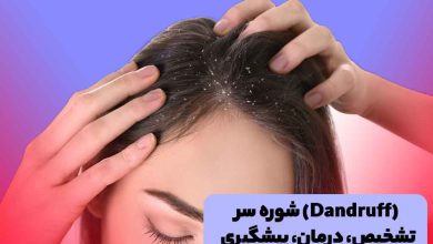 شوره سر و خارش