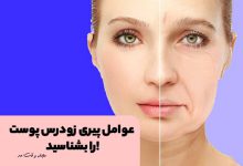 پیری زودرس پوست یا افتادگی پوست