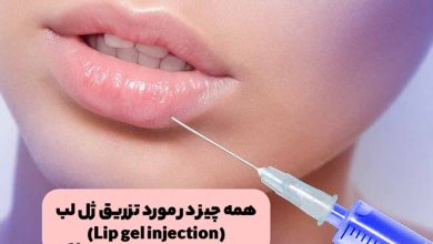 تزریق ژل لب برای حجم دهی به لب