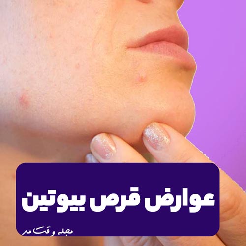 عوارض استفاده از قرص بیوتین را بر روی صورت مشاهده میکنید که بصوت لک و جوش است.
