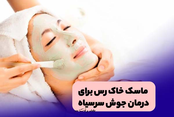ماسک خاک رس برای درمان و از بین برئن جوش سر سیاه صورت