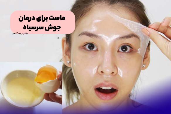 ماسک سفیده تخم مرغ، یکی از انواع ماسک خانگی برای درمان جوش سرسیاه