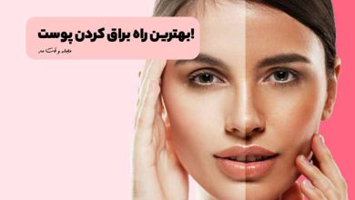 براق شدن پوست صورت