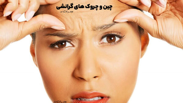 یکی از انواع چین و چروک، چین و چروک گرانشی است که به صورت طبیعی و در طول زمان به وجود می آید.