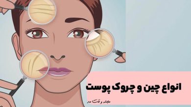 انواع چین و چروک پوست، علت و درمان در مجله وقت مد