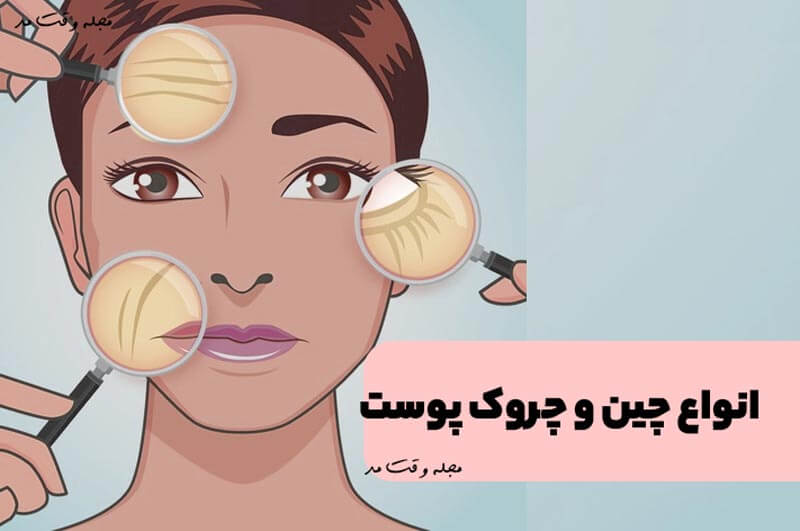 انواع چین و چروک پوست، علت و درمان (مطالب مهم)
