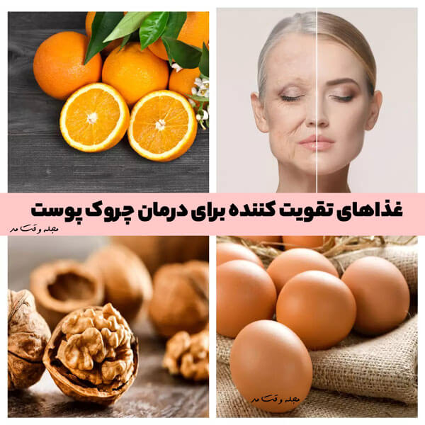 آموزش انواع غذاهای تقویت کننده پوست جهت درمان چین و چروک پوست در مجله وقت مد.