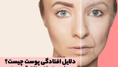 دلایل افتادگی پوست چیست؟ با روش های درمان شلی و افتادگی پوست آشنا شوید!