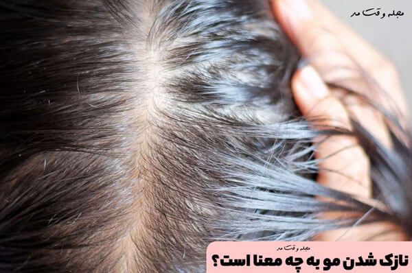 نازک شدن مو می‌تواند به طور طبیعی بر اثر افزایش سن رخ دهد، زیرا فولیکول های مو به پایان چرخه زندگی خود می‌رسند و پس از آن دیگر رشد نمی‌کنند.