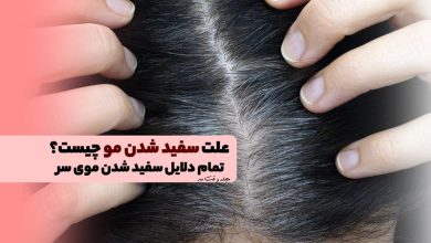 علت سفید شدن مو چیست؟ تمام دلایل سفید شدن موی سر