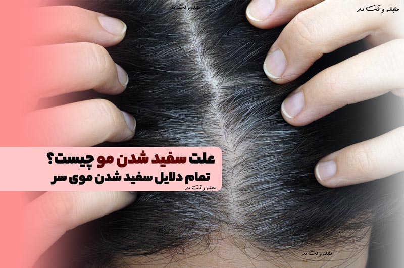علت سفید شدن مو چیست؟ تمام دلایل سفید شدن موی سر