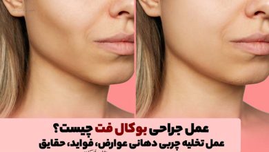عمل جراحی بوکال فت چیست؟ تخلیه چربی دهانی (Buccal fat) عوارض، فواید، حقایق