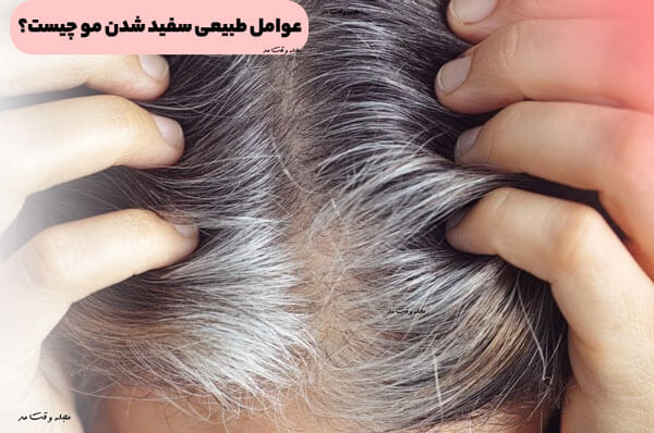 عوامل طبیعی سفید شدن مو چیست؟
