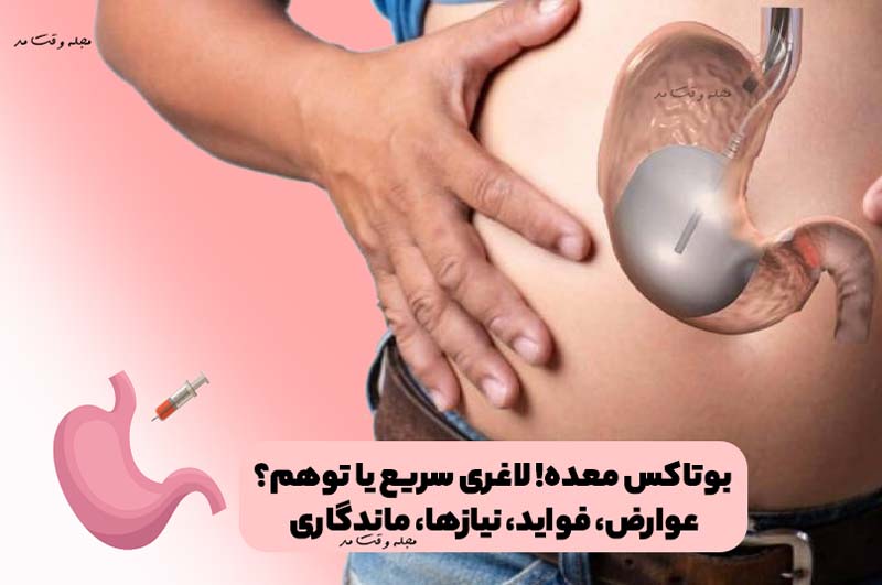 بوتاکس معده! لاغری سریع یا توهم؟ عوارض، فواید، نیازها، ماندگاری