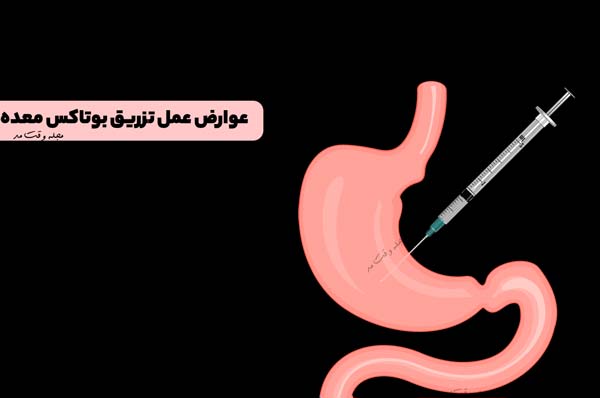 عوارض عمل تزریق بوتاکس معده
