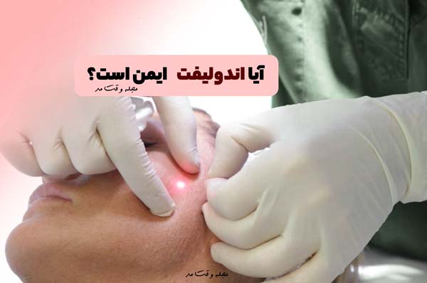 آیا اندولیفت (Endolift) ایمن است؟