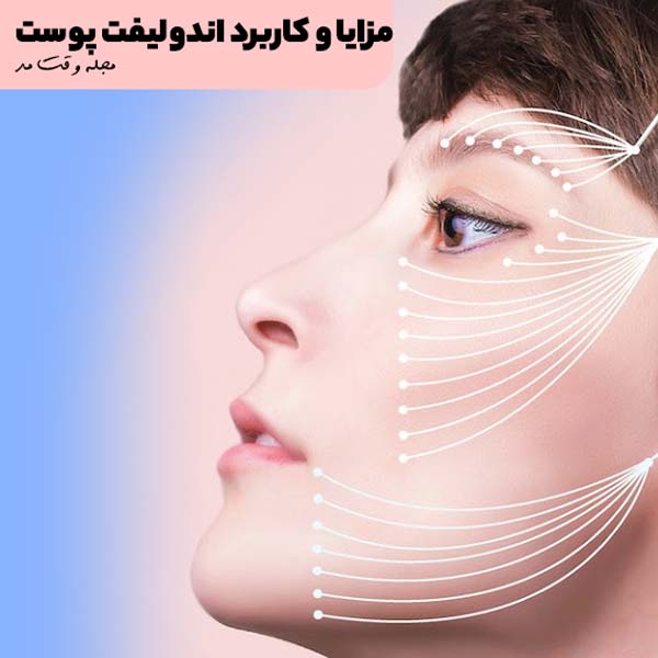 مزایا و کاربرد اندولیفت پوست