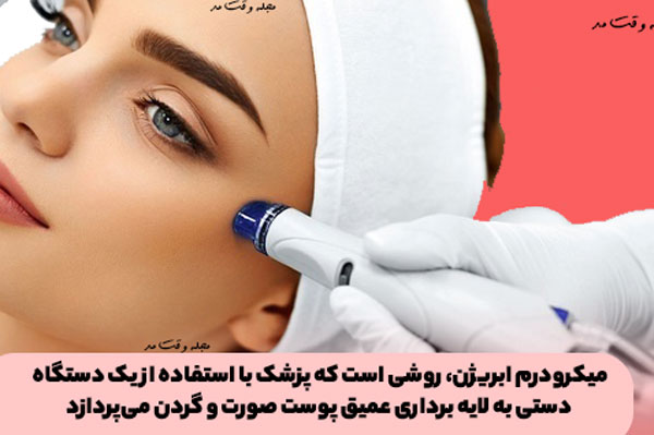 میکرودرم ابریژن، روشی است که پزشک با استفاده از یک دستگاه دستی به لایه برداری عمیق پوست صورت و گردن میپردازد