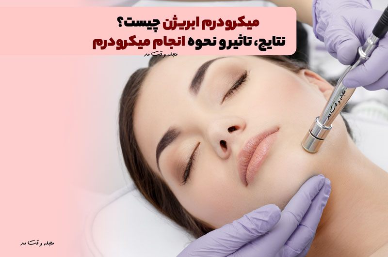 میکرودرم چیست؟! نتایج، تاثیر و نحوه انجام میکرودرم ابریژن