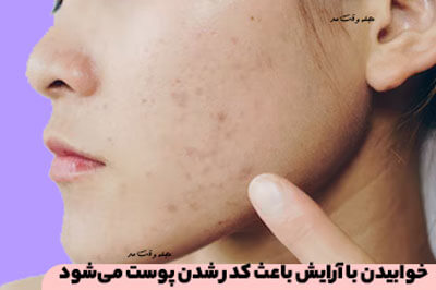 خوابیدن با آرایش باعث کدر شدن پوست میشود