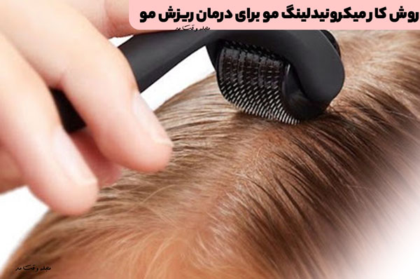 روش کار میکرونیدلینگ مو برای درمان ریزش مو
