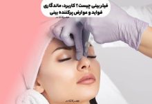 فیلر بینی چیست؟ کاربرد، ماندگاری، فواید و عوارض پرکننده بینی یا رینوپلاستی