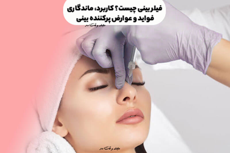 فیلر بینی چیست؟ کاربرد، ماندگاری، فواید و عوارض پرکننده بینی یا رینوپلاستی