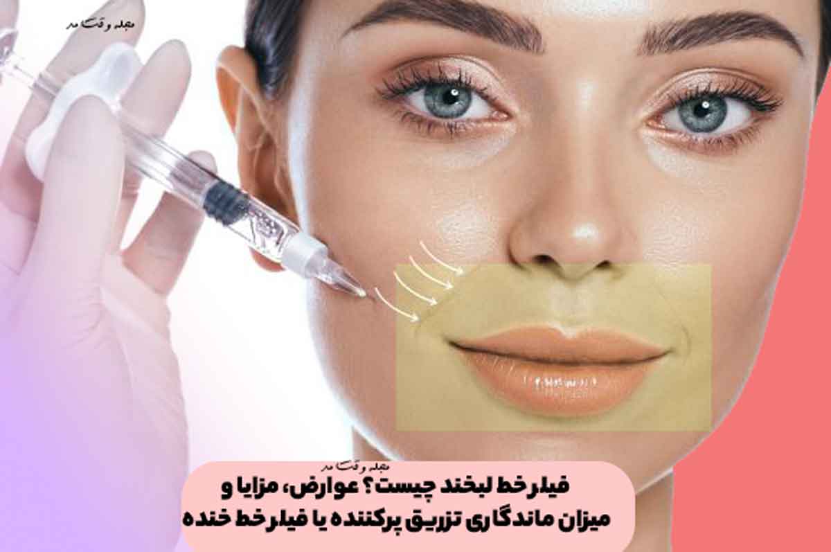 فیلر خط لبخند چیست؟ عوارض، مزایا و میزان ماندگاری تزریق پرکننده یا فیلر خط خنده