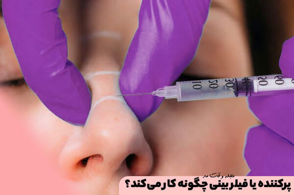 فیلر بینی توسط فرد متخصص و با تجربه، به مناظق مورد نظر تزریق می‌شود.