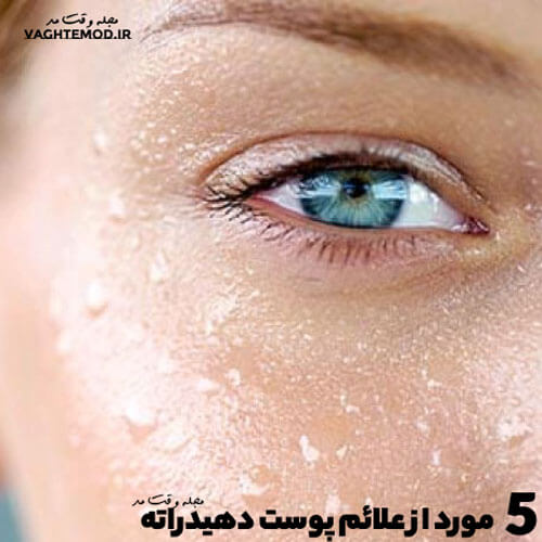 انواع علائم پوست دهیدراته را در مجله علمی وقت مد بخوانید.