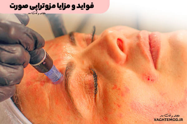 بهبود گردش خون و رفع سموم پیری از جمله فواید و مزایا مزوتراپی صورت است.