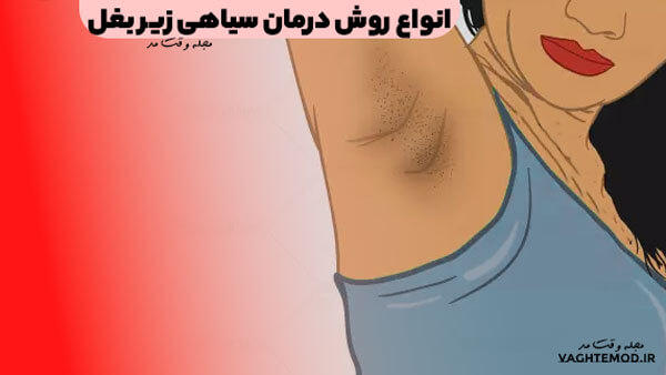 انواع روش درمان سیاهی زیر بغل را در مجله وقت مد بیاموزید.